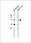CLN3 Antibody (Center)